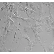 人类骨骼肌卫星细胞 (HSkMSC) - 凸起对比，400倍