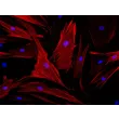 人精囊平滑肌细胞（HSVSMC）- α-SMA 免疫染色，200×
