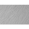 人绒毛间充质成纤维细胞（HVMF）- 浮雕相差显微镜，400×
