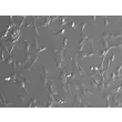 人结肠成纤维细胞（HCoF）- 浮雕相差显微镜图像，200×