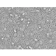 人结膜上皮细胞（HConEpiC）- 相差显微镜，100×
