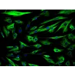 人羊膜上皮细胞（HAmEpiC）- 细胞角蛋白 18（CK-18）免疫染色，200×
