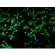 人肠系膜成纤维细胞（HMeF）- 纤连蛋白（Fibronectin）免疫荧光染色，200×