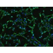 人胃成纤维细胞（HGF）- 纤连蛋白（FN）免疫荧光染色（Sigma-Aldrich，产品编号 #3648），200×
