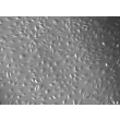 人胎盘血管内皮细胞（HPVEC）- 浮雕相差显微镜，100×
