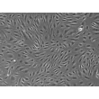 人胎盘血管内皮细胞（HPVEC）- 相差显微镜，100×