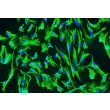 人类脉络丛上皮细胞（HCPEpiC） - 细胞角蛋白-18（CK-18）的免疫染色，200倍。