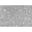 人脉络丛内皮细胞（HCPEC）- 相差显微镜，200×
