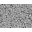 人脐静脉内皮细胞（HUVEC）- 相差显微镜，100×
