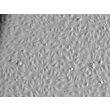 人脐静脉内皮细胞（HUVEC）- 反差显微镜，200×
