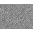 人脐静脉平滑肌细胞（HUVSMC）- α-SMA 免疫染色，400×