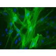 人脐静脉平滑肌细胞（HUVSMC）- α-SMA 免疫染色，400×