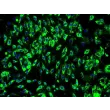 人膀胱微血管内皮细胞（HBdMEC）- vWF 免疫染色，200×