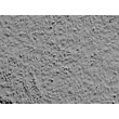 人虹膜色素上皮细胞（HIPEpiC）- 浮雕相差显微镜，100×
