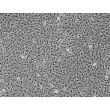 人虹膜色素上皮细胞（HIPEpiC）- 相差显微镜，100×

