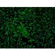人表皮黑色素细胞-浅色型（HEM-l）- S100-β 免疫染色，100x。