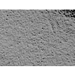 人视网膜色素上皮细胞（HRPEpiC）- 浮雕相差显微镜，100×
