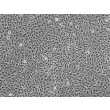人视网膜色素上皮细胞（HRPEpiC）- 相差显微镜，100×

