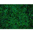 人视网膜色素上皮细胞（HRPEpiC）- CK-18 免疫染色，200×