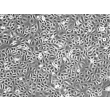 人角膜上皮细胞（HCEpiC）- 相差显微镜，100×

