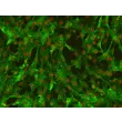 人软脑膜周细胞（HLP）– PDGF 受体-β（PDGFR-β）免疫染色，200×