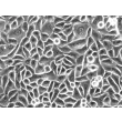 人食管上皮细胞（HEEpiC）- 相差显微镜图像，200×
