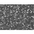 人食管成纤维细胞（HEsF）- 相差显微镜图像，100×