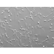 人食管成纤维细胞（HEsF）- 浮雕相差显微镜图像，200×
