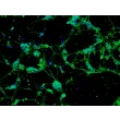 大鼠小脑颗粒细胞（RGC）——β-微管蛋白III免疫染色，200×
