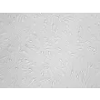 大鼠脑血管周细胞（RBVP）—— 浮雕相差显微镜图像，200×
