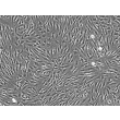 成人心肌细胞（HCM-a）- 相差显微镜（Phase contrast），100 倍。
