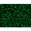 免疫染色图注：牛源星形胶质细胞（BA）— GFAP 免疫染色图像，200×