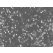 3D culture day 1 post-embedding, 200x (day 1 cond11-0)
