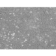 Bovine Brain Microvascular Endothelial Cells (BBMEC) - Phase contrast, 100x
