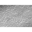 Bovine Dermal Fibroblasts (BDF)-Relief contrast, 100x.