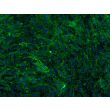 Bovine Meningeal Cells (BMC)-Immunostaining for FN, 200X