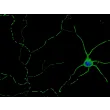 小鼠皮层神经元（MN-c）——β-III型微管蛋白免疫染色图像，600倍

