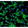 小鼠神经束膜成纤维细胞（MPNF）— 纤维连接蛋白（Fibronectin）免疫荧光染色，200×放大。
