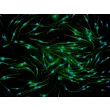 骨髓来源小鼠巨噬细胞（MMa-bm）——CD11b免疫染色，200×