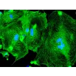 HPSC-Derived Cardiomyocytes (H9-CM) –Immunostaining for α-actinin, 400X