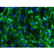 hPSC-Derived Endothelial Cells (hPSC-EC) -
Immunostaining for CD31, 200x

