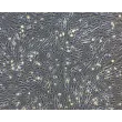 hPSC-Derived Endothelial Cells (hPSC-EC) - Phase contrast, 100x