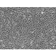 Human Adipose-derived Mesenchymal Stem Cells (HMSC-ad) - Phase contrast, 100x.