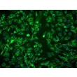Human Amniotic Mesenchymal Stromal Cells (HAMSC) - Immunostaining for CD105, 200x.
