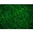 Human Annulus Fibrosus Cells (HAFC) - Immunostaining for Fibronectin, 200x.
