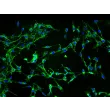 Human Aortic Adventitia Fibroblasts (HAAF) - Immunostaining for Fibronectin, 200x.