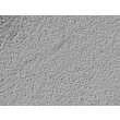 Human Aortic Endothelial Cells (HAEC) - Relief contrast, 100x.