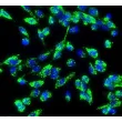 Human Aortic Endothelial Cells (HAEC) - Immunostaining for vWF, 200x.