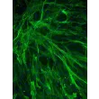 Human Aortic Smooth Muscle Cells (HASMC) - Immunostaining for α-SMA, 200x.