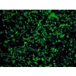 Human Astrocytes-cerebellar (HA-c) - Immunostaining for GFAP, 100x.

